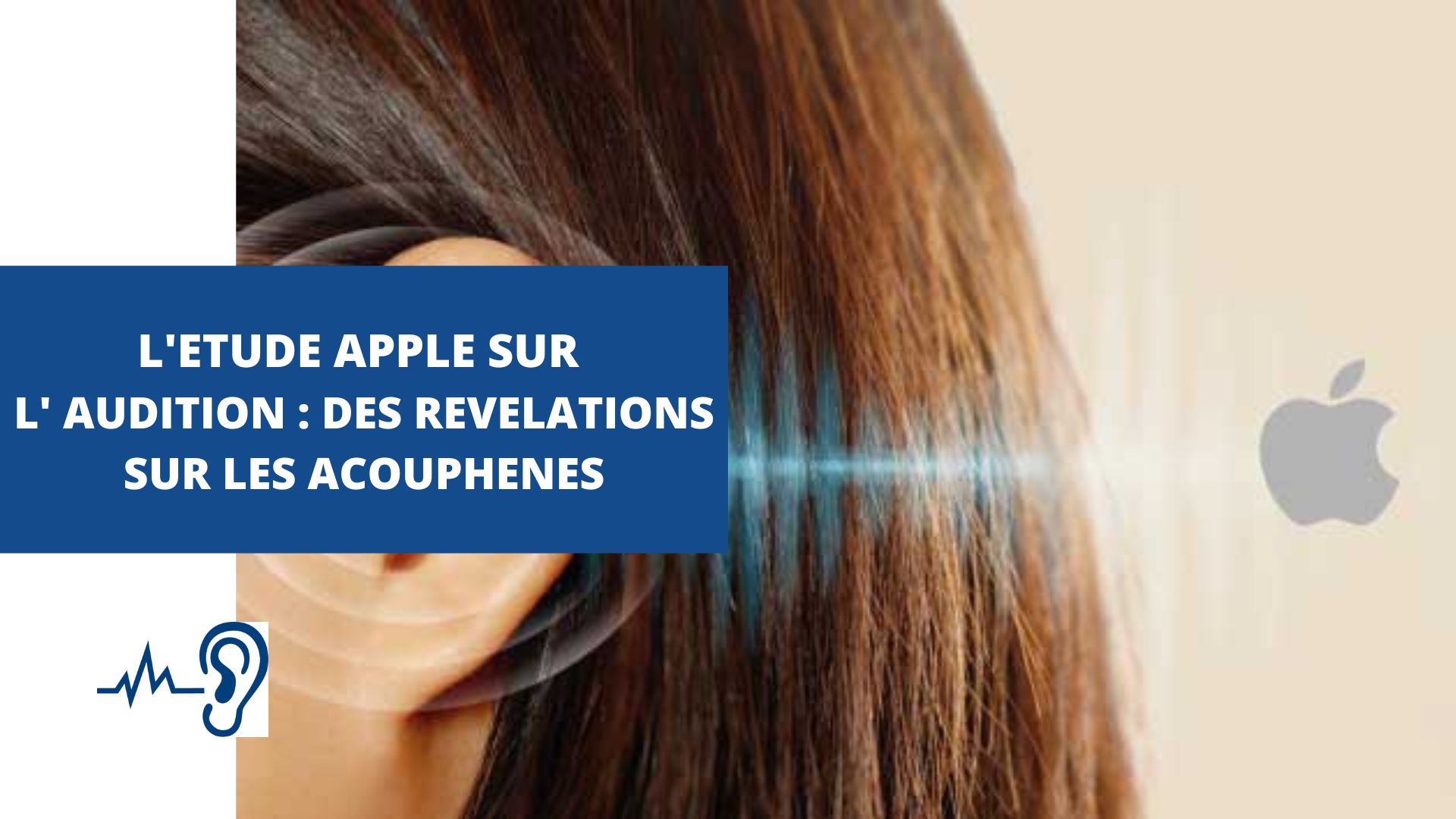 acouphene-apple